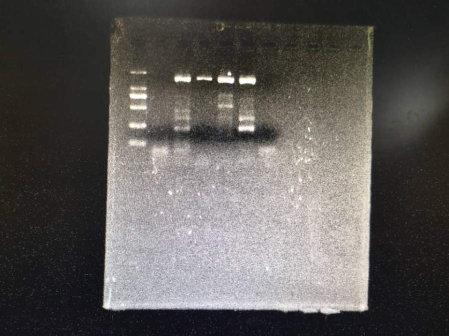 采用水煮法提取细菌dna;16s rrna pcr扩增;琼脂糖凝胶