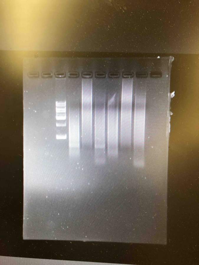 pcr 条带一直是一大片模糊的